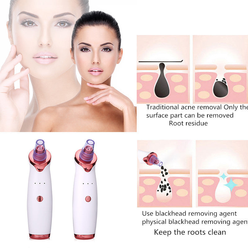 GlowClear Blackhead Vacuum & Pore Cleaner